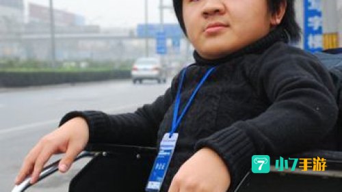 瓷娃娃病友